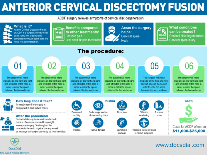 Anterior Cervical Discectomy Fusion